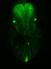 Live-mouse-embryo-with-Jagged1-GFP-transgenic-reporter