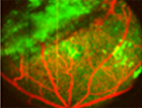 The rodent eye as a non-invasive window for understanding cancer nanotherapeutics