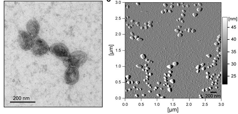 Exosome Diagnostics