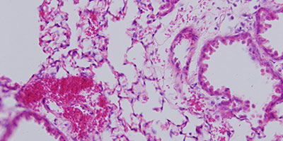 Lung Image