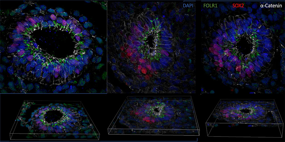 Neural Tube Development and Defects